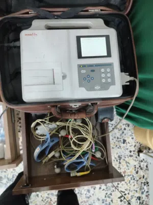 جهاز تخطيط قلب ECG