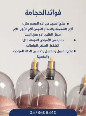 اخصائي حجامة طبية معتمد -خدمة منزلية معقمة