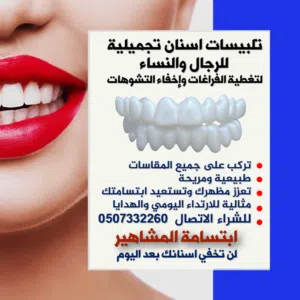 تلبيسات اسنان تجميلية