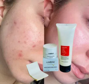 عناية بالبشرة