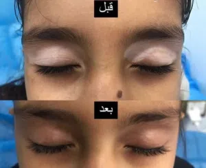 لتوحيد اللون