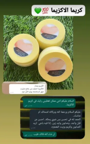 كريم الاكزيما