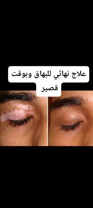 لتوحيد اللون