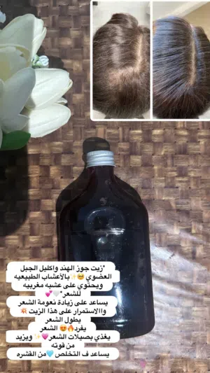 خلطه السدر    وشامبو  سدر طبيعي   الرأس  علاج فوري للشعر  التساقط  الفرق من اول غسلة مع حنا العلاجي