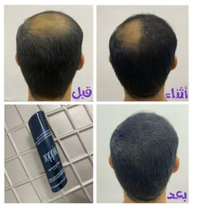 ألياف بناء الشعر الطبيعية Toppik