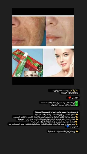 Skin Care . Lotion & Cream . New4