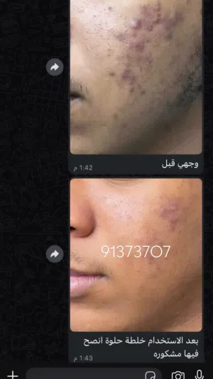 خلطات تفتيح لرجال وتناسب العساكر مضمونة
