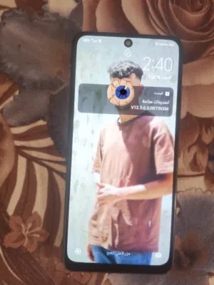 Redmi Note 11 Pro