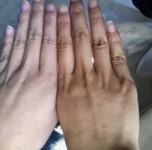 كريمات تفتيح البشره