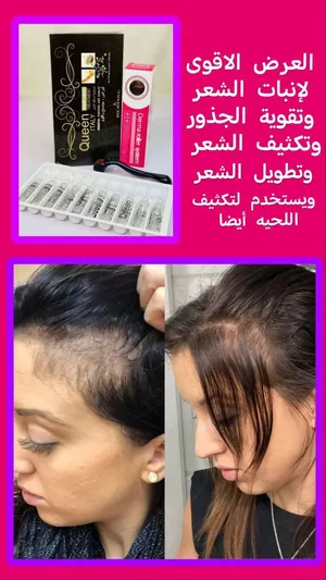 ‏العناية بالشعر ‏.‏ كريمات معالجة ‏.‏ جديد‏3