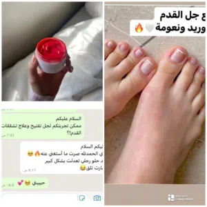 مورد القدم ومبيض للقدم عند اول طلب تحصل لوشن تفتيح اليد مجانا