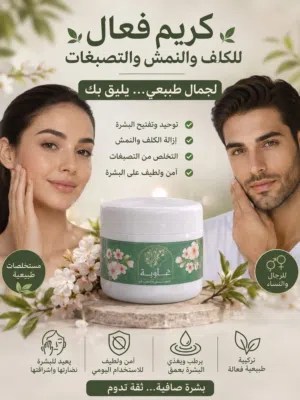 كريم الغاويه الكلف والنمش والتصبغات