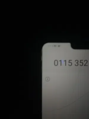 0115352****