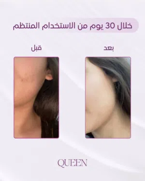 كوين سنتر لتبييض وتفتيح البشرة