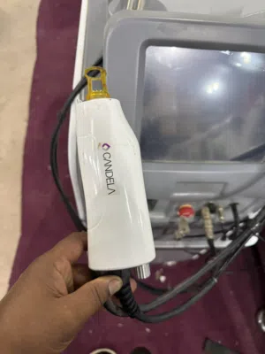 CANDELA LASER MACHINE