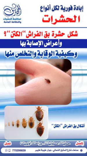 مكافحة الحشرات في صنعاء مكافحة الكتن في صنعاء مكافحة الصراصير في صنعاء مكافحة بق الفراش في صنعاء