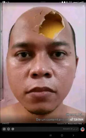 DAF 