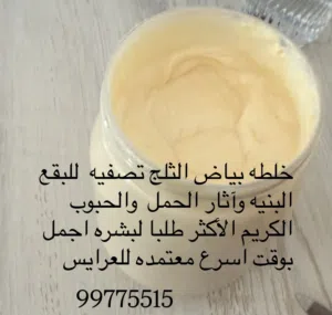 الخلطه الظفارية للتفتيح وتصفيه البشره