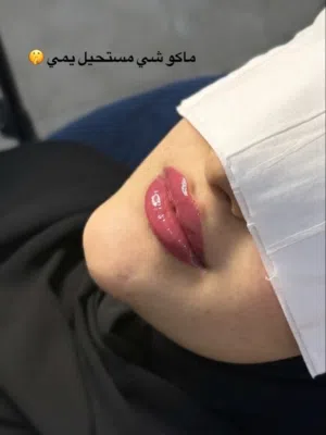 تجميل غير جراحي