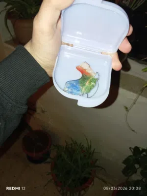 جهاز تقويم للاسنان