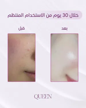 بكج كوين سنتر
