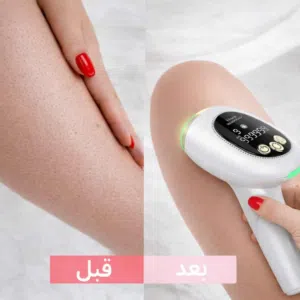 عرض نار الاقوي في المملكه ع جهاز ليزر  بسعر الجمله الكميه محدوده     جهاز ليزر إزالة الشعر الم