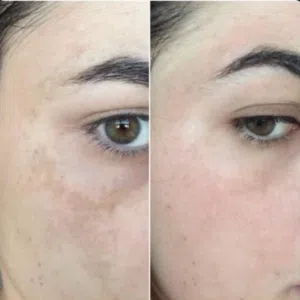 سيروم عرق السوس الأصلي