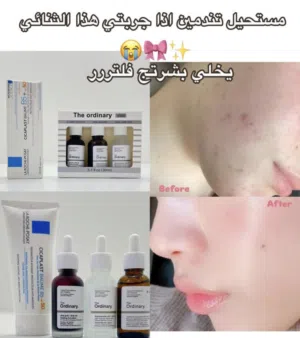 السلام عليكم عروض العيد توفر اقوى بكج عليه سحب والكمية محدودة جداً يعني لو تحصلها لو تخسرها لا تفوتو