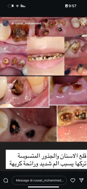 عالج اسنانك مجاناً وي دكتور ميثم