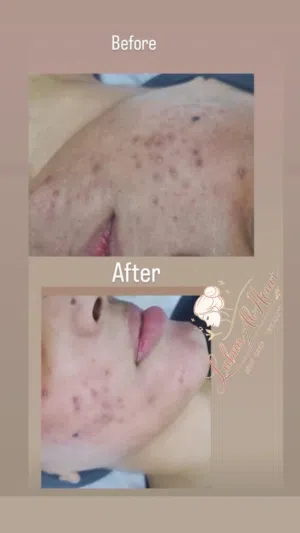 اخصائية بشرة