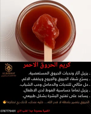 وفرنالكم من جديد علاج الحروق الاحمر الله لا يضركم وهو غني عن التعريف لازالة درجات الحروق باكملها