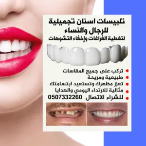 اغطية اسنان تجميلية