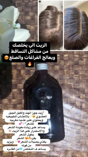 خلطه السدر    وشامبو  سدر طبيعي   الرأس  علاج فوري للشعر  التساقط  الفرق من اول غسلة مع حنا العلاجي
