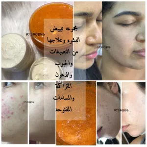 كريم تبييض الوجه 2026