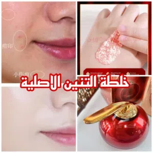 احدث ما توصلت اليه كوريا بعالم التجميل تقنية كريم دم التنين للتبيض الفوري والدائمي خلطة دم التنين ال