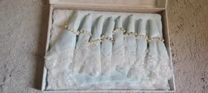 Set of 8 Light Blue Lace Napkins with Pearl Rings (New in Box)