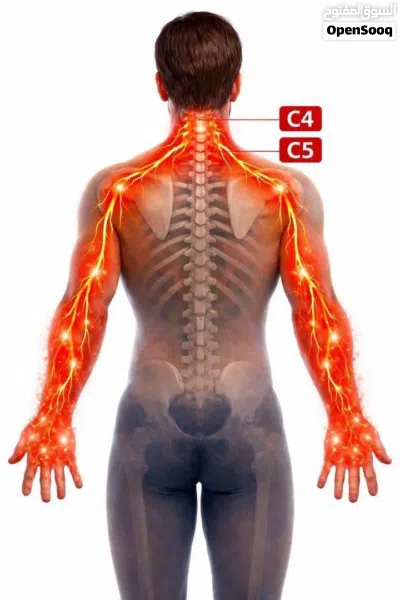 علاج طبيعي 3