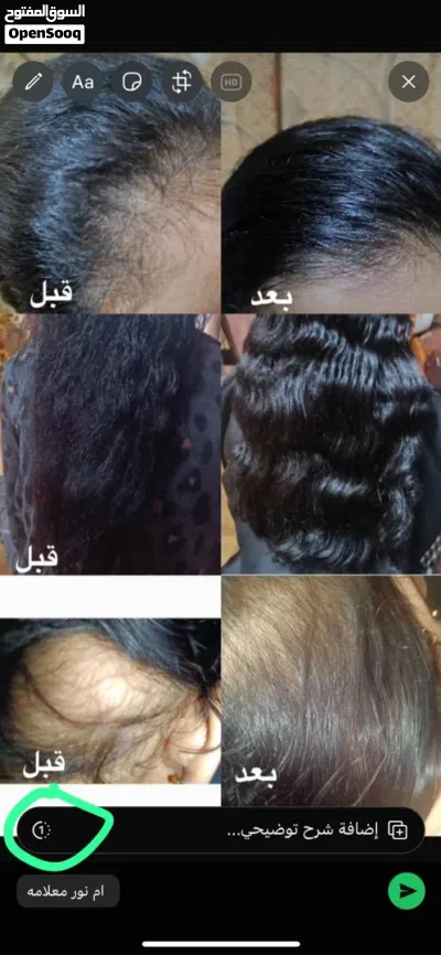زيت شعر ينعم ويطول ويكثف 4