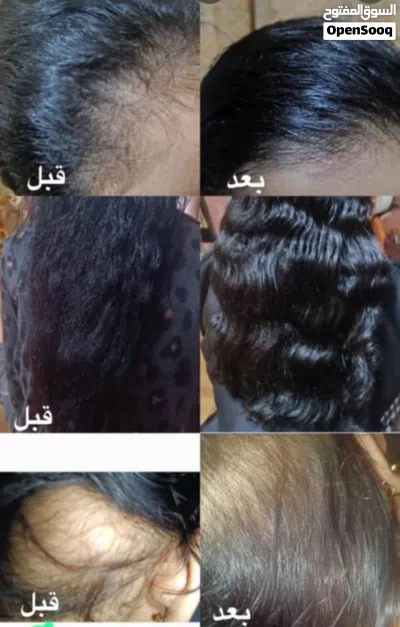 زيت لتنعيم وتطويل وتكثيف الشعر 3