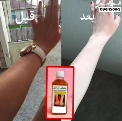 منتج تبيض وجه 4