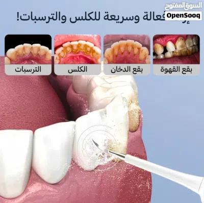 جهاز تنظيف الأسنان من التكلسات 2