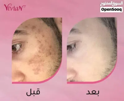 رجع توفرررر من جديد العشق اللي الكل ينتظره! اطلبي كريم فيفيان الاصلي واظمني بشرة صافية، نضر 2