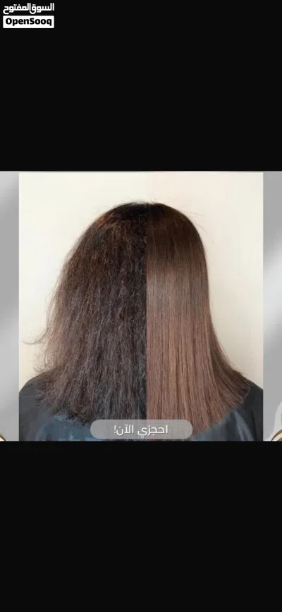 عرض على البروتين ب 20 بروتين برازيلي خالي من الفورمالين 2