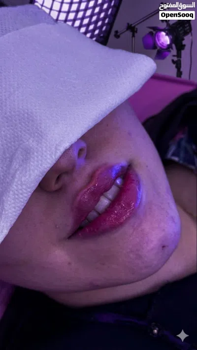 تجميل غير جراحي 3