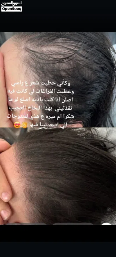 البخاخ العجيب 4