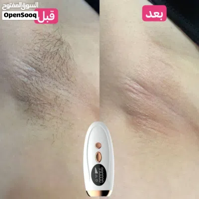 جهاز ليزر بيتي 4