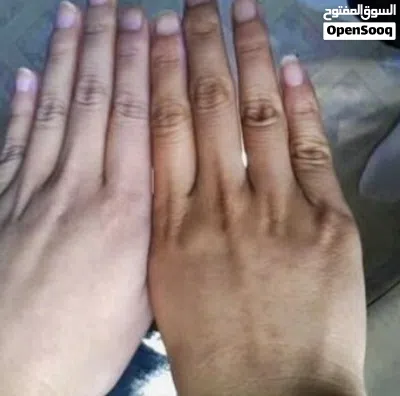 كريم تبيض الوجه والجسم مضمون 4