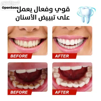 معجون تبيض الأسنان الفعال stain removal toothpaste 3