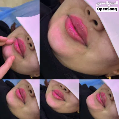 تجميل غير جراحي 2