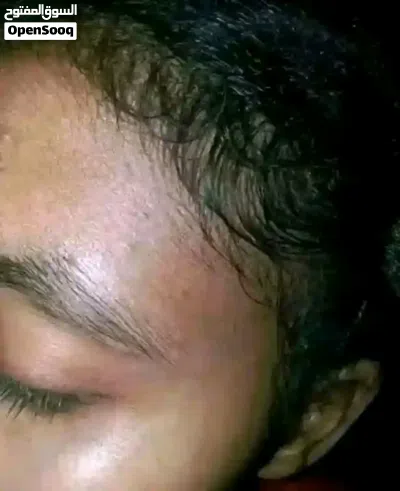 زيت جيكا مكس الاصلي لحل مشاكل الصلع الجلحات التساقط الفراغات وجميع مشاكل الشعر والتطويل 4